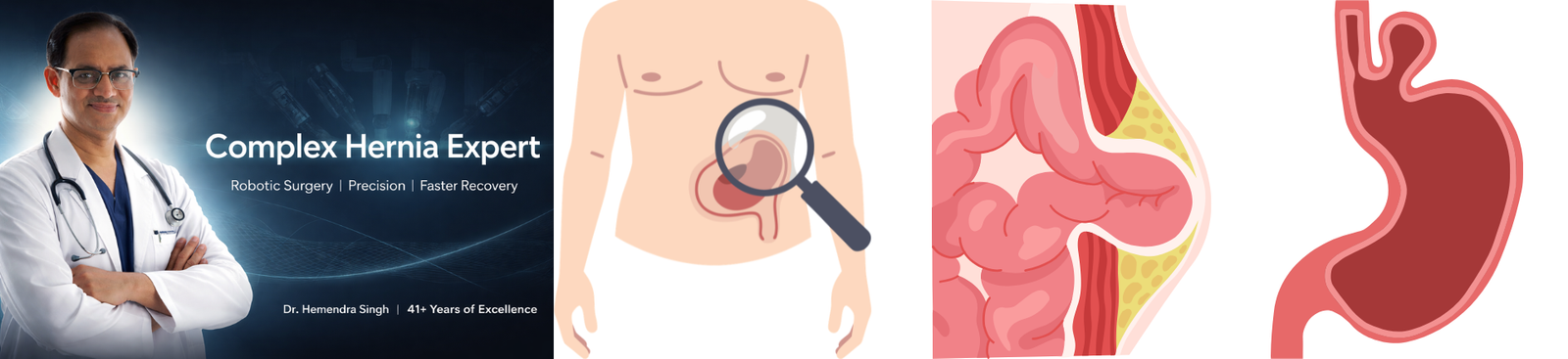 Complex Hernia Surgery Expert